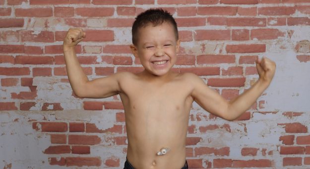 Visit Helping children with Pediatric Feeding Disorders survive and thrive. page